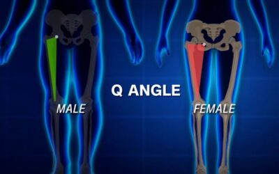ACL injuries are not uncommon among female athletes. Although there are several factors that may come into play
